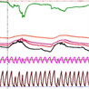 Temperature Monitoring